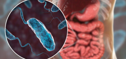 तीन जिल्लामा २० जनामा हैजा पुष्टि